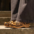 What Are Clogs?